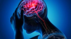 alzheimer etude