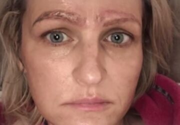 microblading drame quatre sourcils