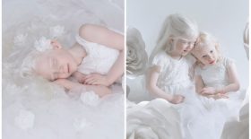 Une photographe décide de mettre les albinos à l'honneur dans un shooting photo