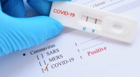 covid-contaminations-tests