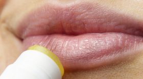Nos astuces pour soigner le bouton de fièvre naturellement