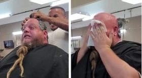 épilation
