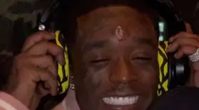 rappeur lil uzi vert incruste diamant sur le front
