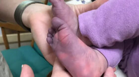 bébé coronavirus infection