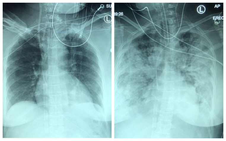 galerie-rayon-x-covid