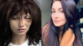 madison mère overdoses transformation