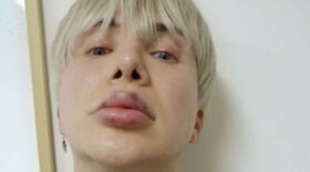 lèvres botoxées chanteur k-pop