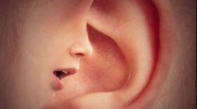 oreille dinde