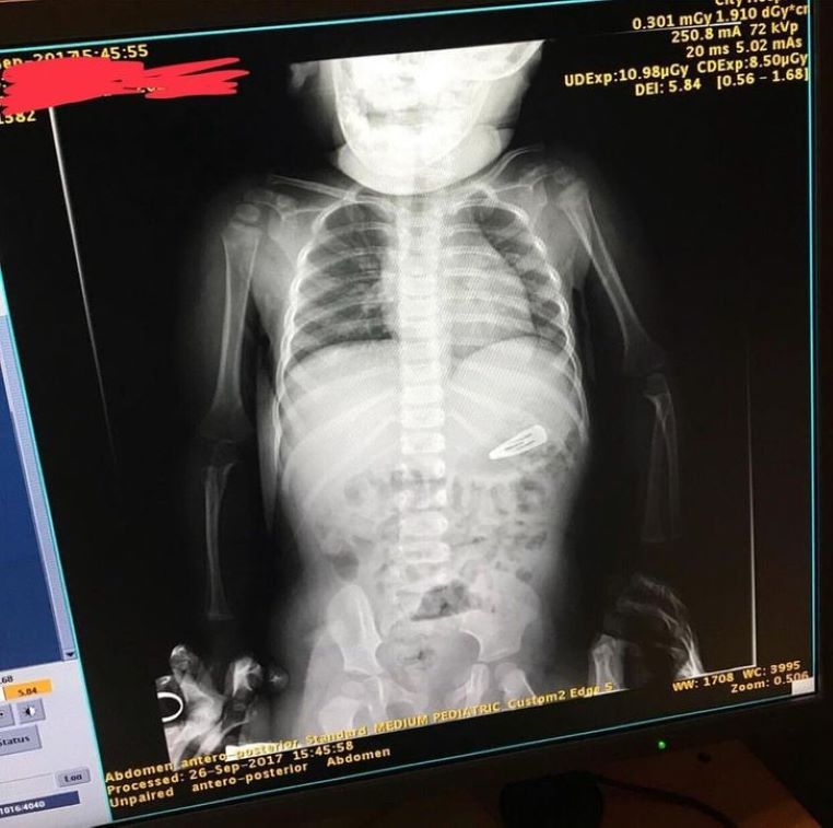 galerie-rayon-x-fille-barrette