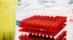 Vaccin AstraZeneca Norvège