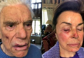 tapie-agression-interview
