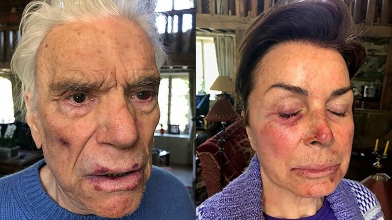 blessures-violence-couple-tapie