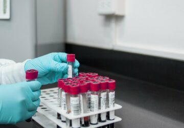 France : les département où les variants sud-africain et brésilien circulent le moins