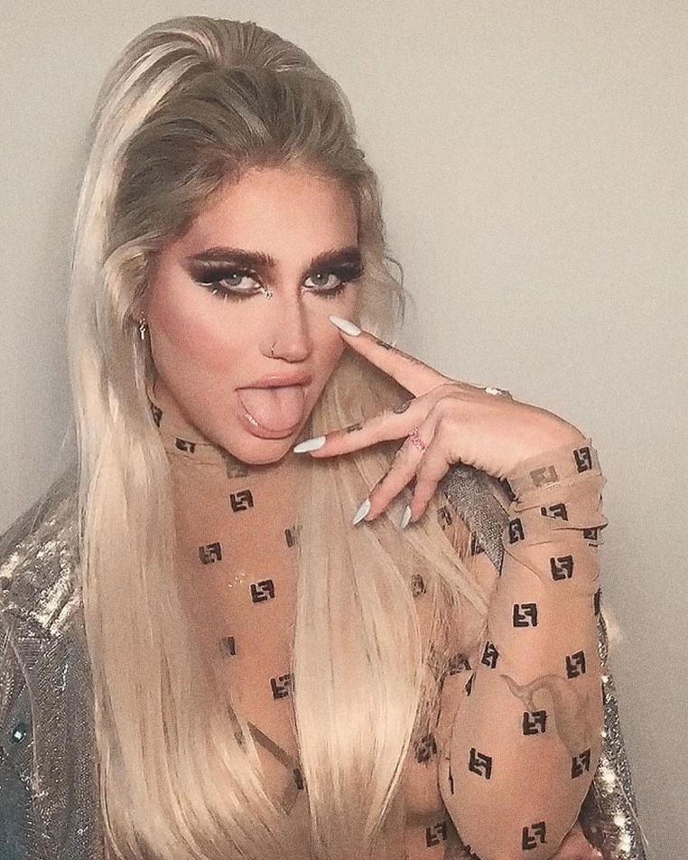 gallerie-stars-mauvaise-hygiène-kesha