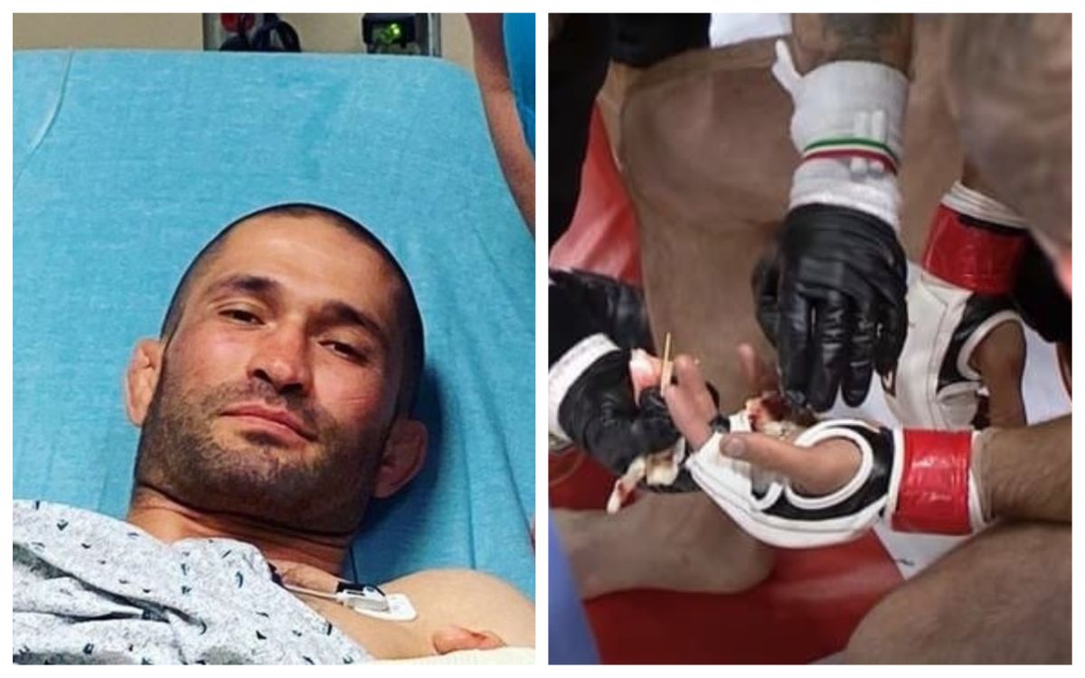 Ce champion de MMA perd son doigt en plein combat (vidéo)