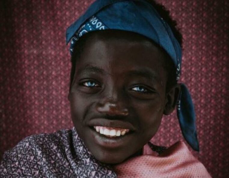 Ce garçon éthiopien a de rares yeux bleus, mais ça lui a apporté beaucoup de problèmes dans la vie