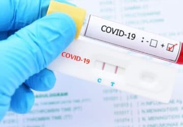 Pass Sanitaire : Combien va coûter le test PCR ?