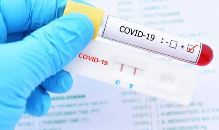 Pass Sanitaire : Combien va coûter le test PCR ?
