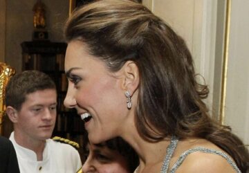 kate middleton cicatrice intrigue