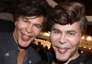 Igor et Grichka Bogdanoff : le secret de leur menton dévoilé... Et ce n'est absolument pas une maladie !