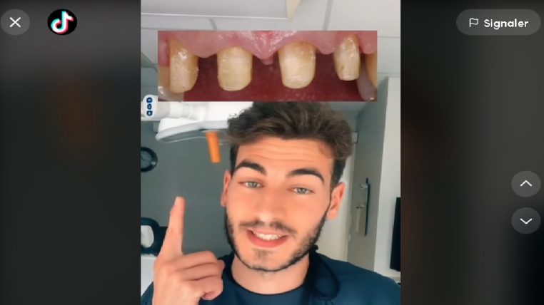 Tendance TikTok : se faire tailler les dents ! Un dentiste alerte sur les terribles dangers de cette pratique ! (vidéo)