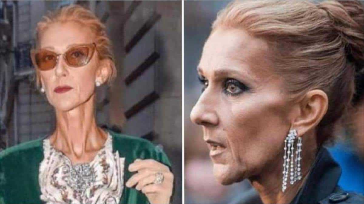 celine dion malade