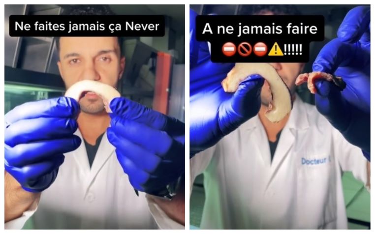 docteur-iza-tiktok-peau-penis-probleme-video-conseils