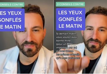 yeux conseil