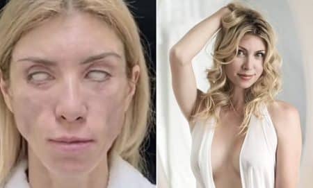 chirurgie reine beauté