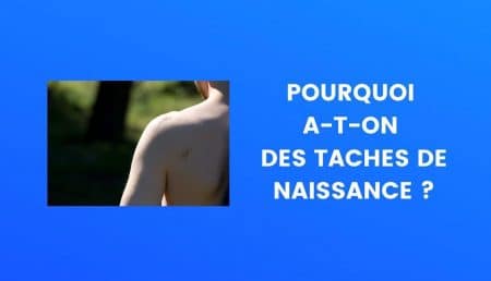 Taches de naissance