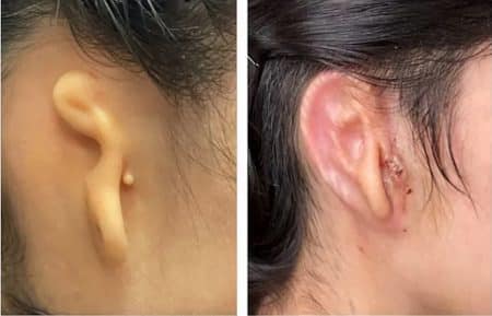 oreille