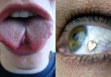 Chirurgie esthetique