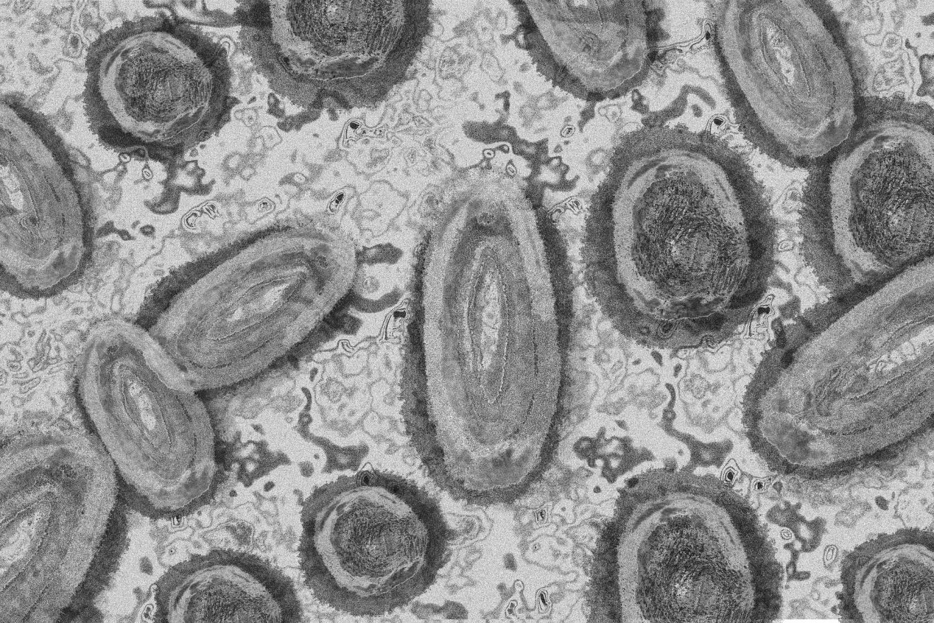 Le directeur général de l’OMS déclare une urgence de santé publique de portée internationale concernant la variole du singe