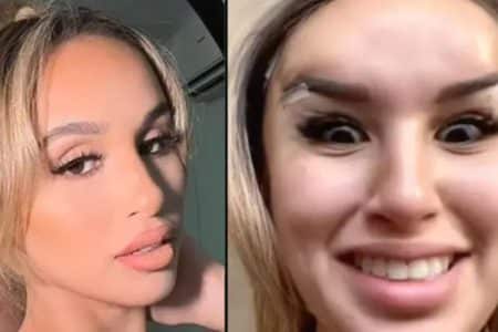 operation chirurgie esthetique