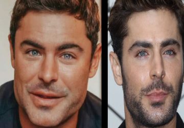 Zac Efron accro de la chirurgie esthétique ? L'acteur prend la parole