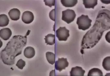 globule blanc