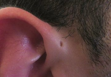 trou oreille