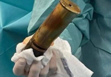 A 88 ans, il arrive aux urgences avec un obus coincé dans l'anus. L'hôpital évacué !