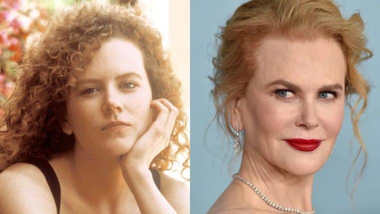 nicole kidman actrice star chirurgie