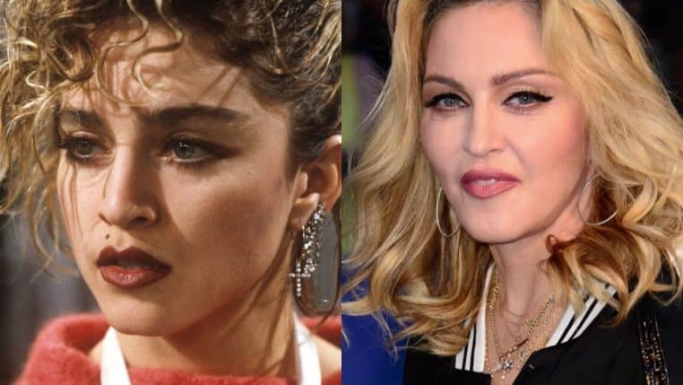 madonna musique chanteuse star chirurgie