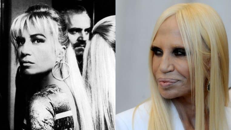 donatella versace mode chirurgie