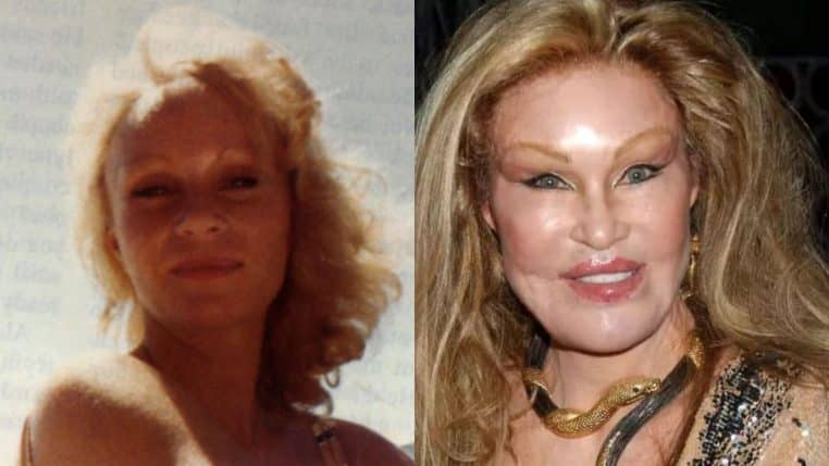 jocelyn wildenstein new york chirurgie