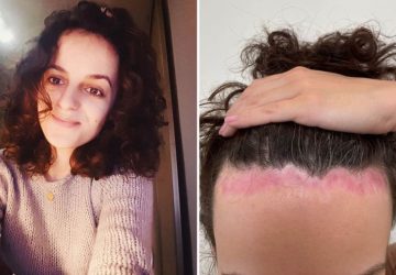 La réduction du front, tendance TikTok