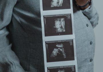 Insolite elle tombe enceinte d'un deuxième bébé, alors qu'elle est déjà enceinte