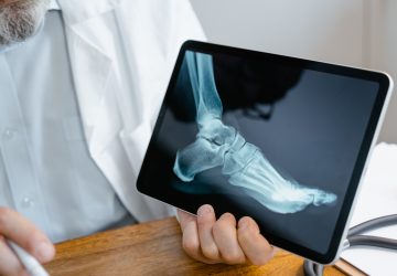 Une infirmière ampute le pied d'un patient sans autorisation