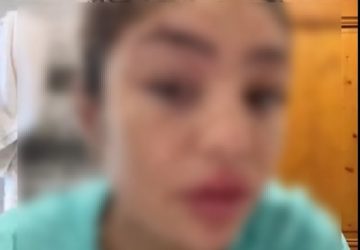 telerealite candidate defiguree chirurgie