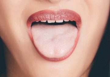 langue noire poilue peur cancer traitement antibiotiques