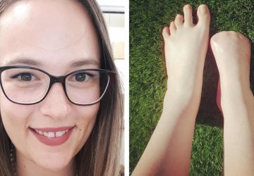 Elle se fait amputer les orteils après avoir réalisé un soin très connu
