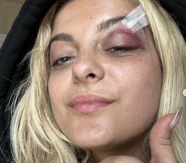 Bebe Rexha concert téléphone insolite smartphone blessé