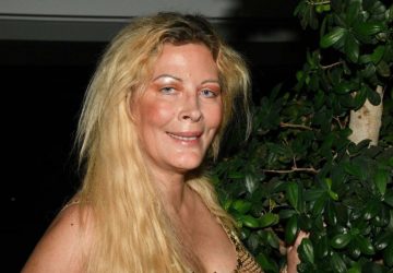 Loana révèle enfin comment elle a perdu ses dents